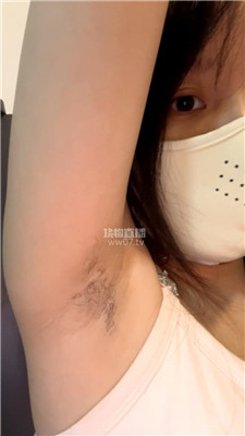 【兔牙】腋下口水    251125-16